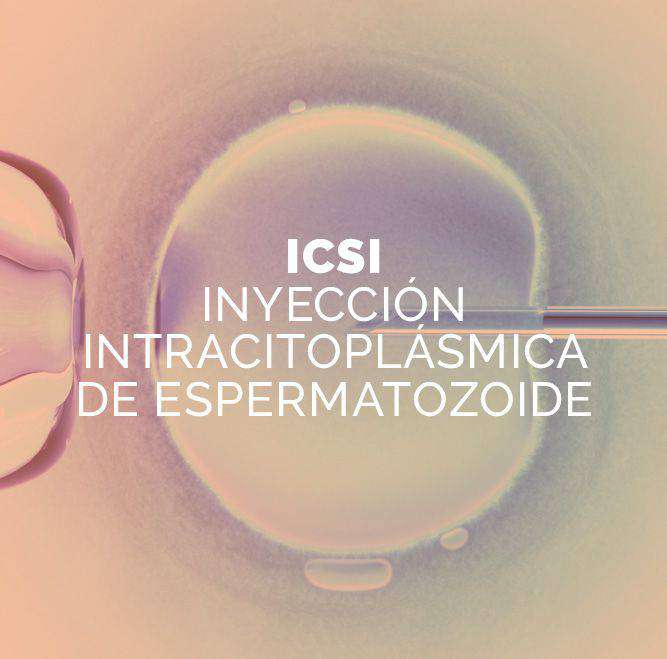 tratamiento icsi