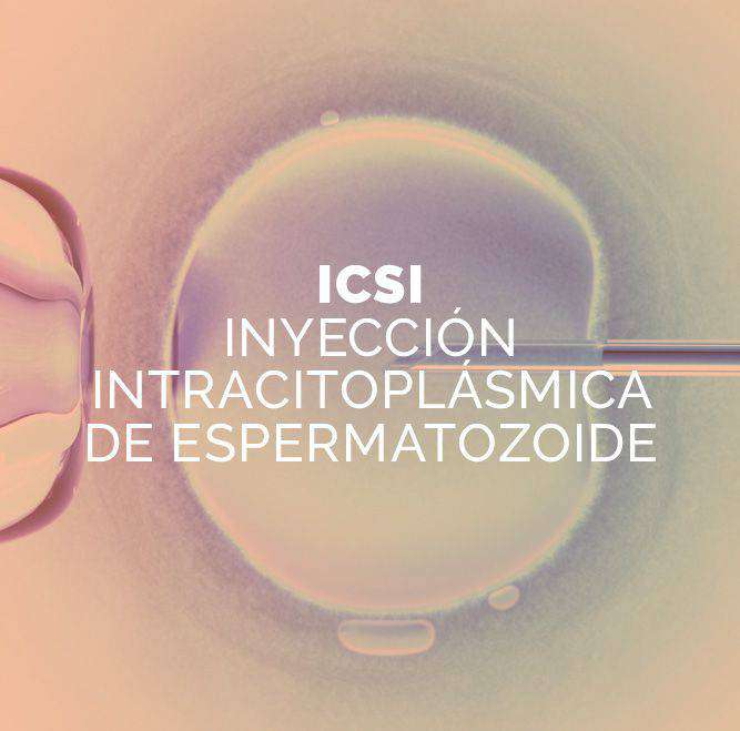 tratamiento icsi