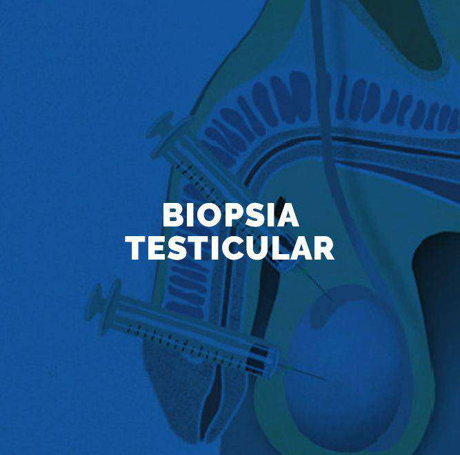 tratamiento biopsia testicular